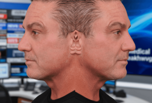 Сотрудники ИТ-сферы Кремниевой долины увеличили спрос на пластику